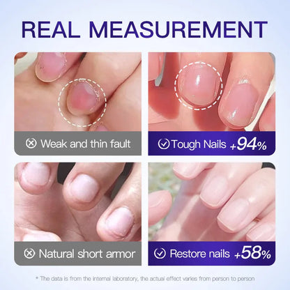 Cross-border Foreign Trade Wholesale Essence for Moisturizing, Nail